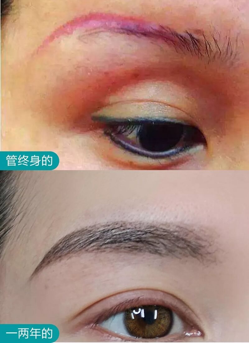 做了半永久纹眉能维持多久啊？会不会几个月就掉色啊？
