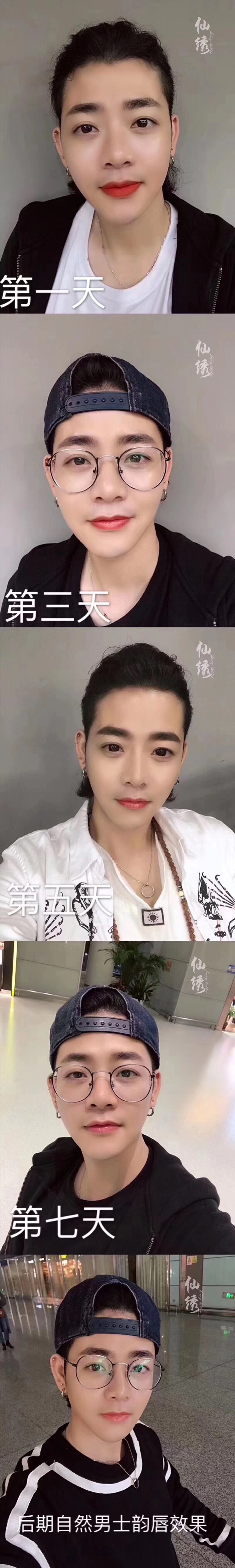 纹唇一到七天恢复图片(纹仙绣仙韵红唇前后对比照片)