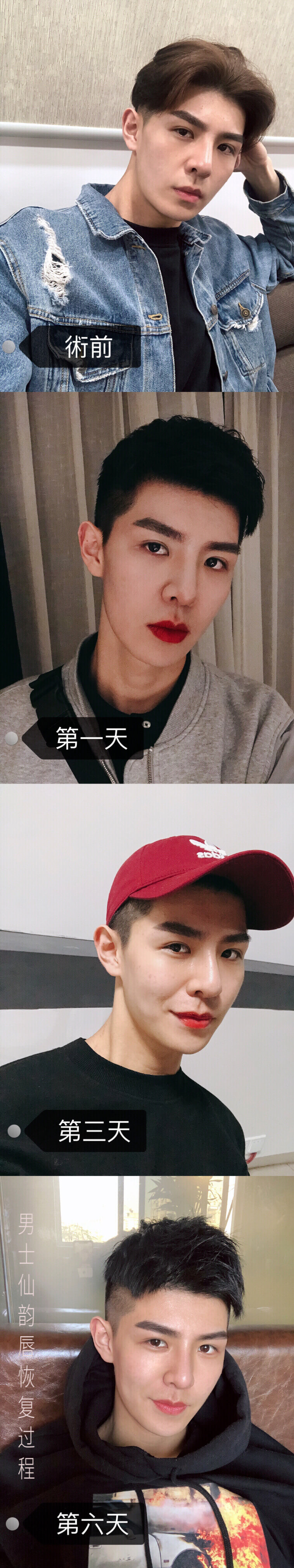 男士纹唇一到七天恢复图片(纹仙绣仙韵红唇前后对比照片)