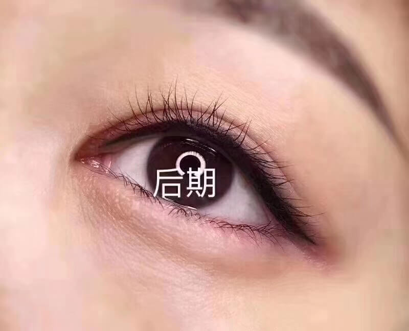 美瞳线后期照片