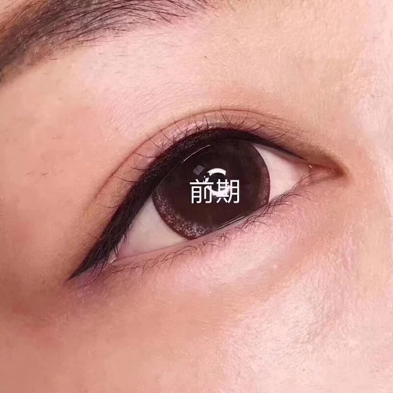 美瞳线前期照片